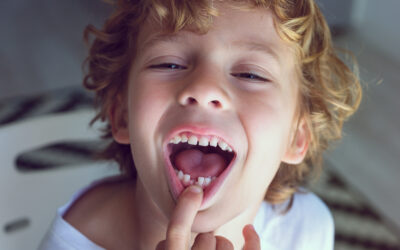 ¿Qué significa el espacio entre los dientes de leche?